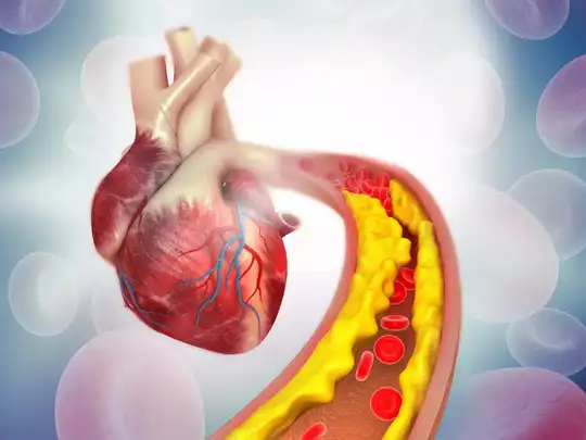 Heart attack in Gujarat